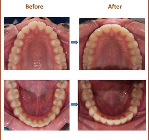 Before and After Expansion Results